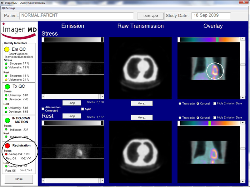 ImagenMD